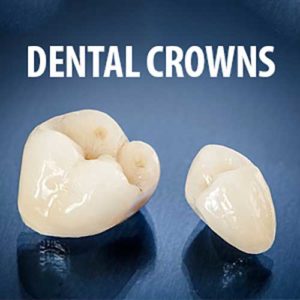 Image of Dental Crowns