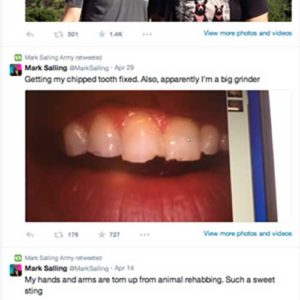 post related to tooth grinding