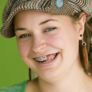 Girl smiling with missing teeth